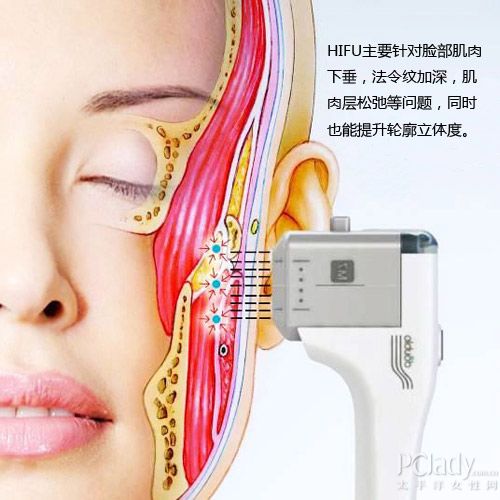 Best HIFU Face lifting Beauty Equipment