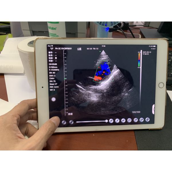 Wireless Phased Array Ultrasound Transducer Handheld Cardiac Echography Wireless Ultrasound Probe Price for Sale