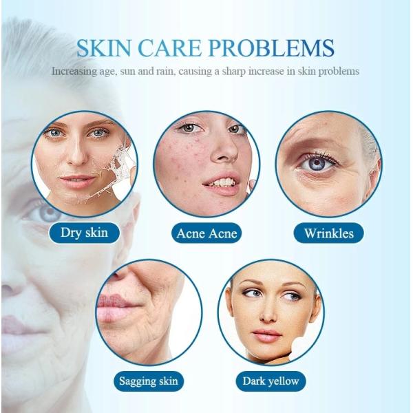 4 In 1 Face Suction Photon Rejuvenation Oxygen Facial Whitening