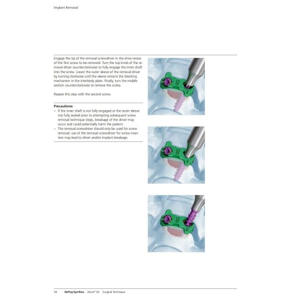 Sterilization 2 Screws Zero Profile Cage Anterior Cervical Cage Stand Alone CE Spinal Surgery