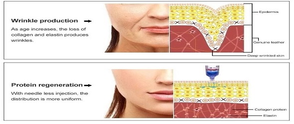Handle Needle Free Mesotherapy Machine Injection For Skin Care