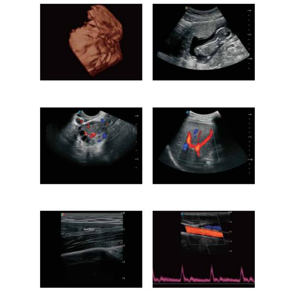 Sonoscape S12 Trolley Color Doppler System Digital Color Doppler Ultrasound System Pregnancy Scanner
