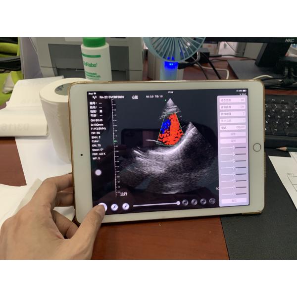 Wireless Phased Array Ultrasound Transducer Handheld Cardiac Echography Wireless Ultrasound Probe Price for Sale