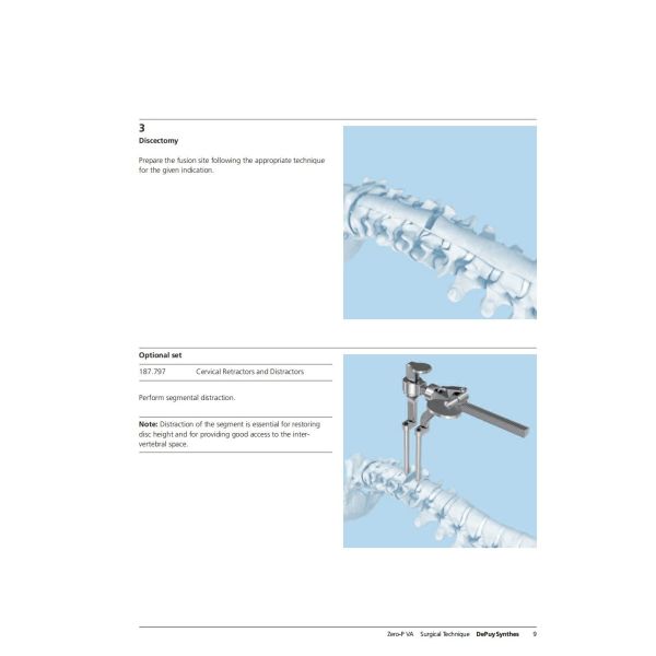 Sterilization 2 Screws Zero Profile Cage Anterior Cervical Cage Stand Alone CE Spinal Surgery