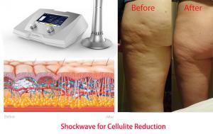 Buy cheap acoustic wave therapy magnetic wave therapy ultrasonic slimming equipment product