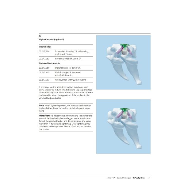 Sterilization 2 Screws Zero Profile Cage Anterior Cervical Cage Stand Alone CE Spinal Surgery