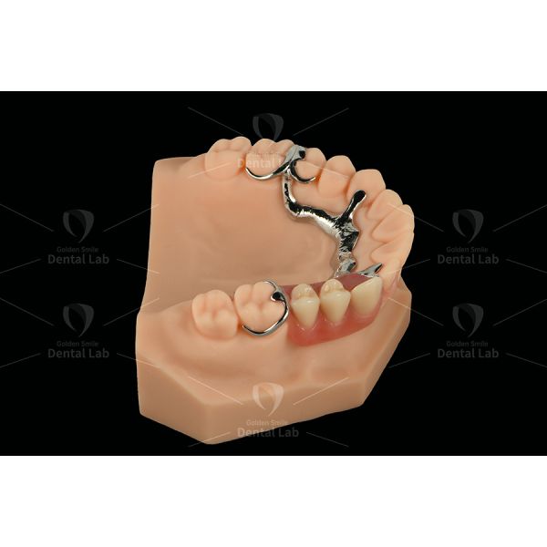 Lightweight Cobalt Chrome Partial Denture Framework Clasp Flexible Acrylic Partial Denture