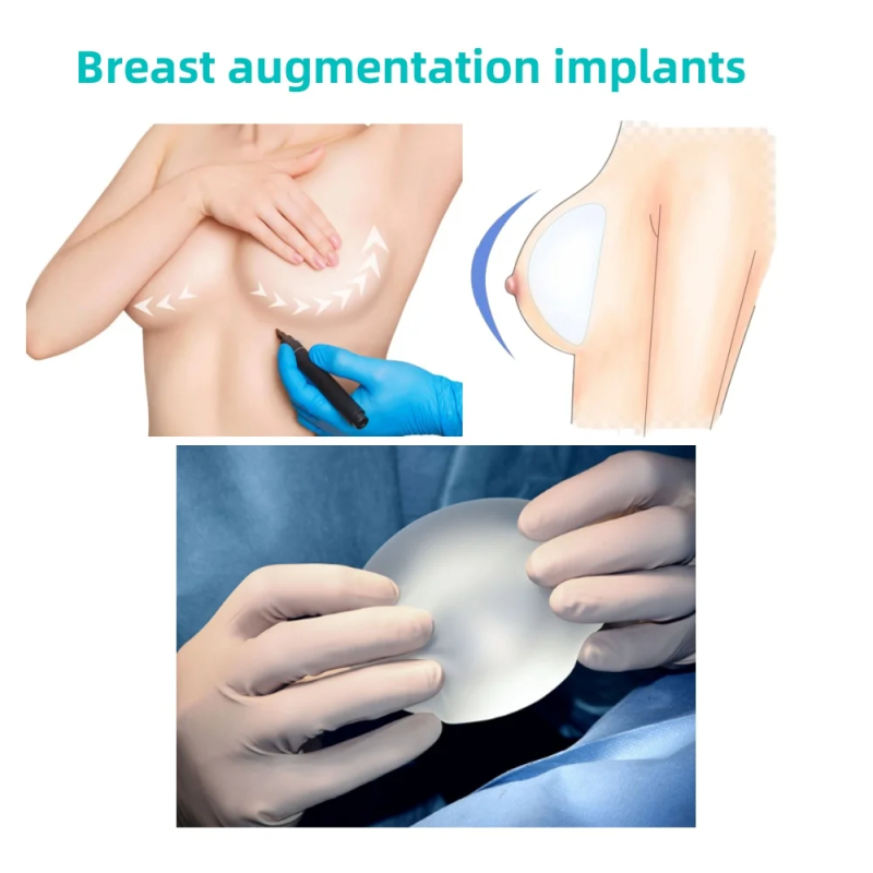 Medical Grade Silicone Gel For Fever-Reducing Patch Silicone Breast Patch Low-Viscosity Self-Adhesive Silicone Gel 1:1
