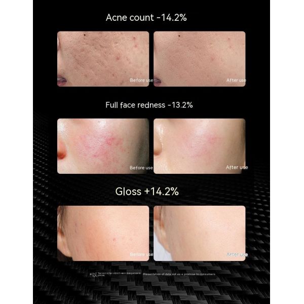 7 Colors led light therapy soft silicone skin whitening led facial mask